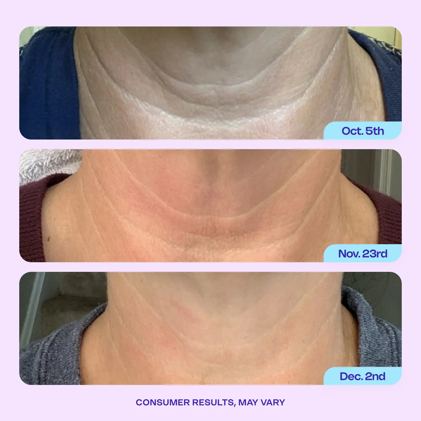 Face and Neck Firming Cream