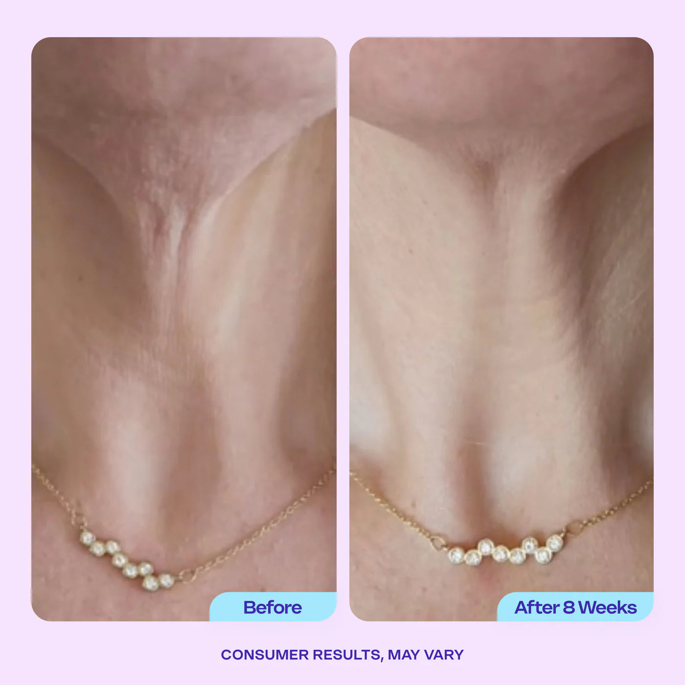 Face and Neck Firming Cream