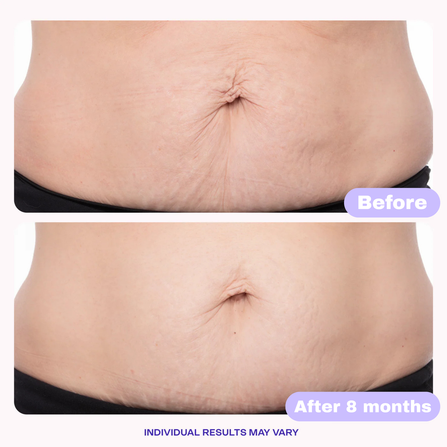 Tighten and Smooth Belly Cream