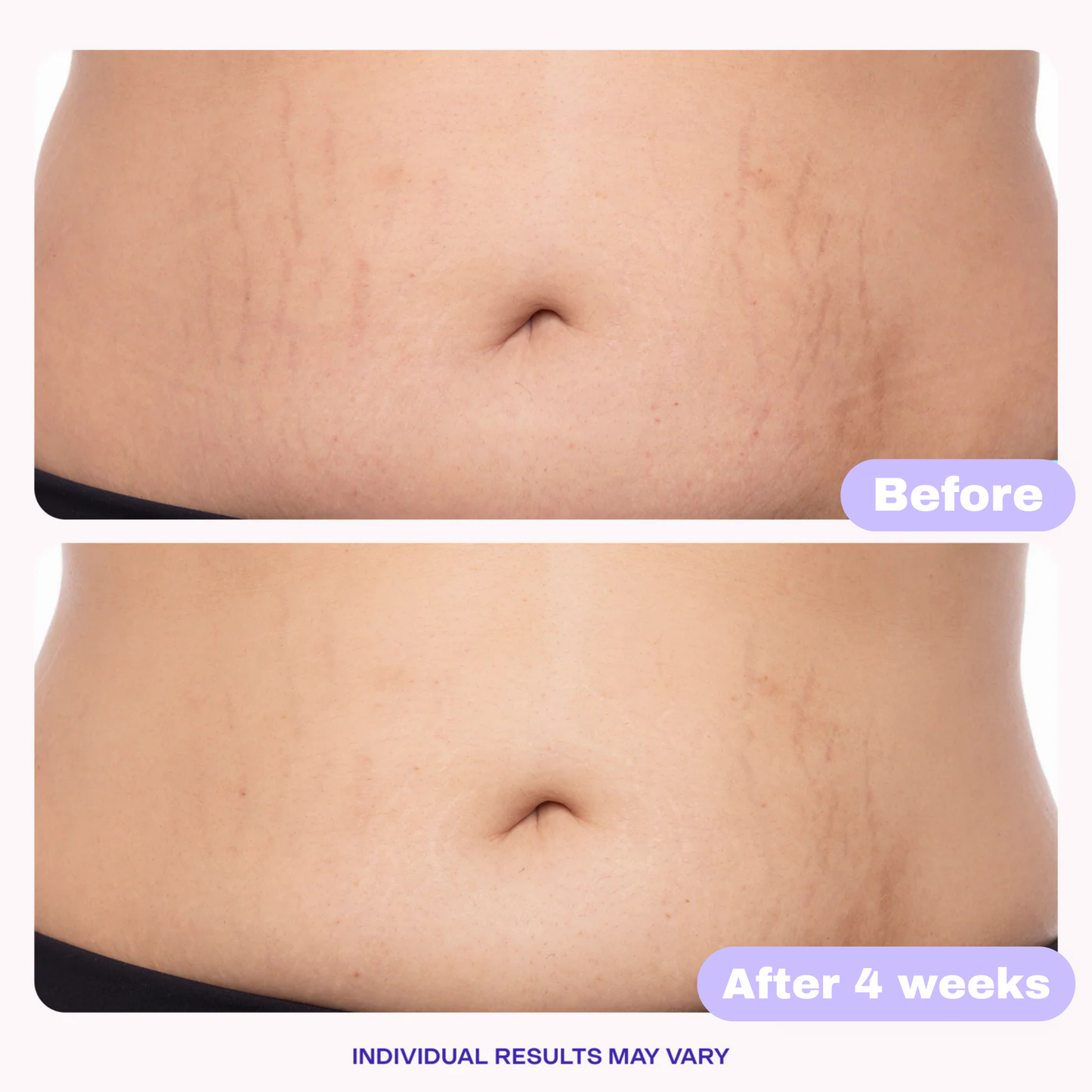 Tighten and Smooth Belly Cream