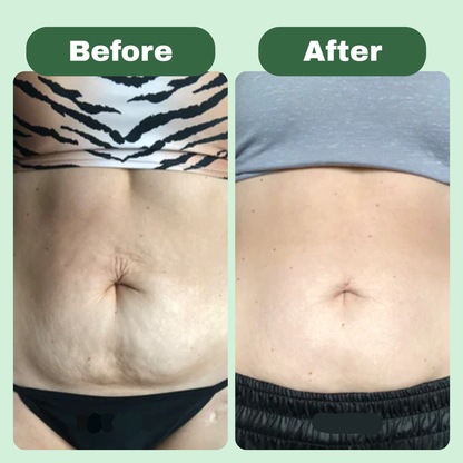 Ryvoro™ Cellulite Massage Oil