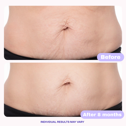 Tighten and Smooth Belly Cream