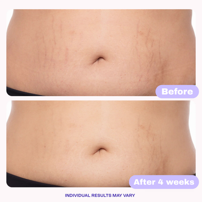 Tighten and Smooth Belly Cream